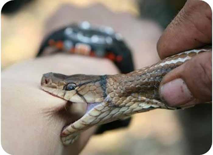 蛇类对类的危害之咬伤
